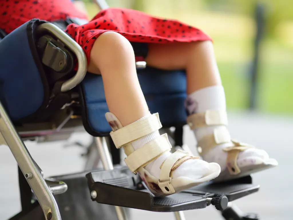 Mózgowe Porażenie Dziecięce (MPD) 2 Mózgowe Porażenie Dziecięce